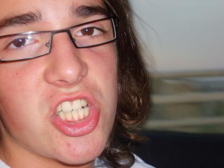 JoE order WHiT-TeeTh